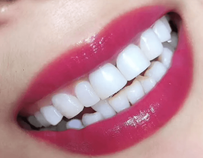 深圳做牙齿矫正哪家口腔诊所效果不错？