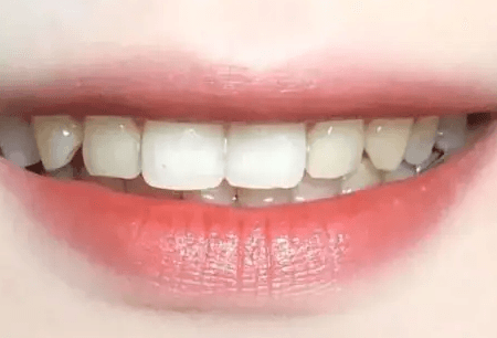 重庆做牙齿治疗哪家私立口腔医院效果不错？