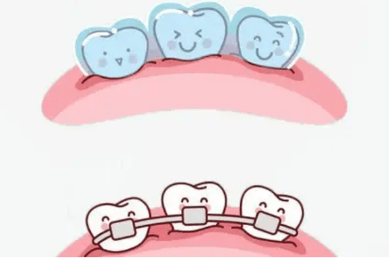 箍牙到老年牙齿有影响吗 箍牙老了以后会怎么样