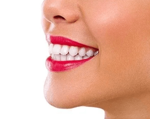 牙齿美白要多少钱 附牙齿美白的术后注意事项