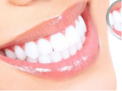 怎样判断牙齿是骨性还是牙性