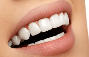 根管治疗后补牙好还是嵌体好 补牙还是做嵌体？